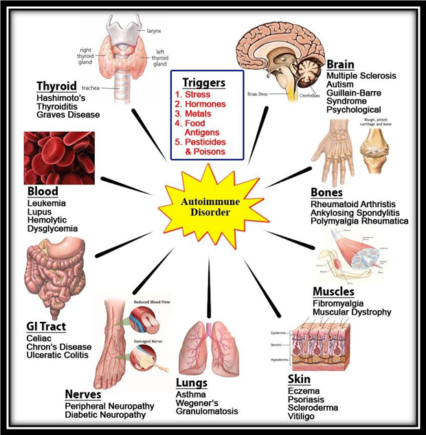 Organ Specific Autoimmune Disorder